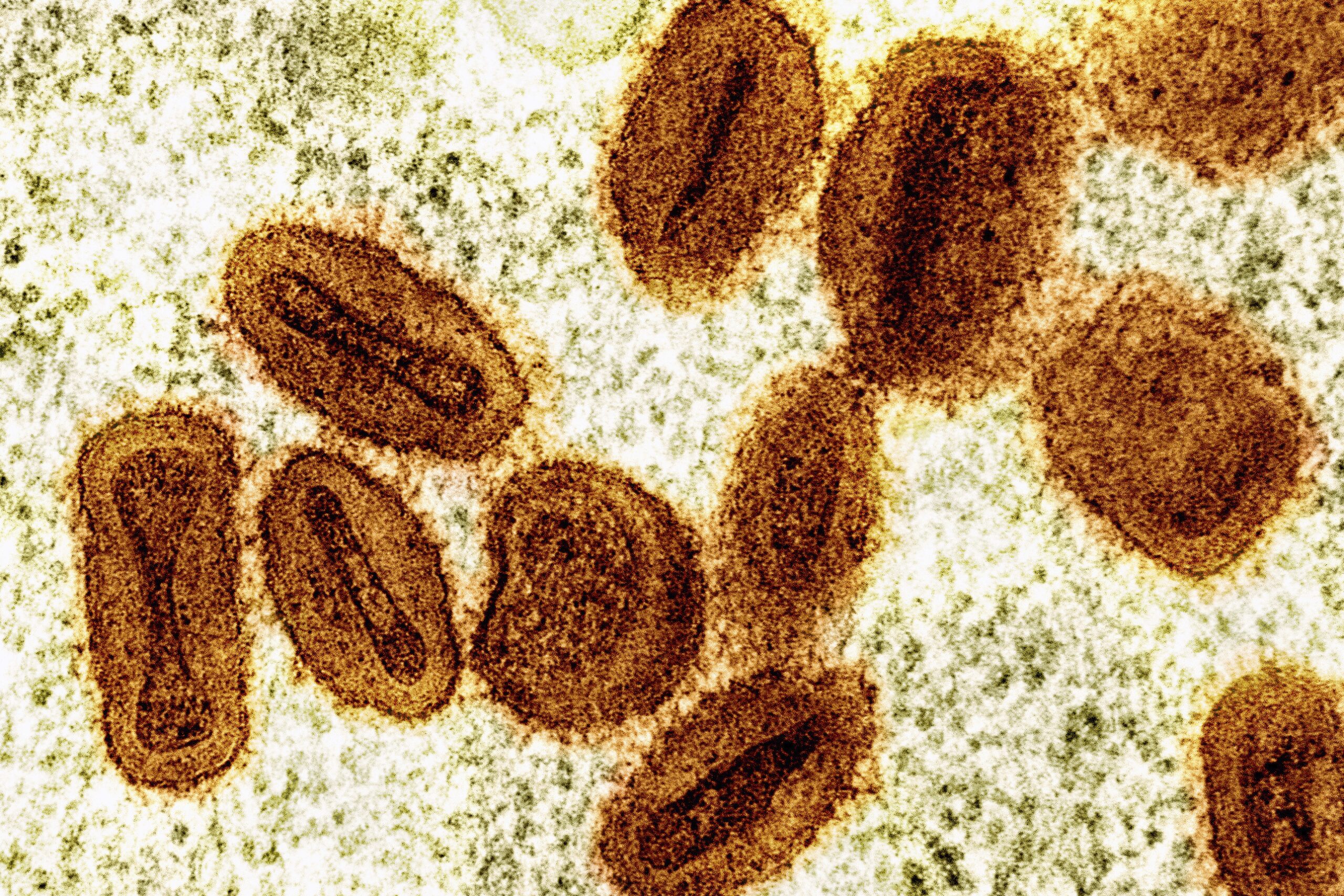 Mpox: casos sobem para oito em Rondônia; criança está entre infectados