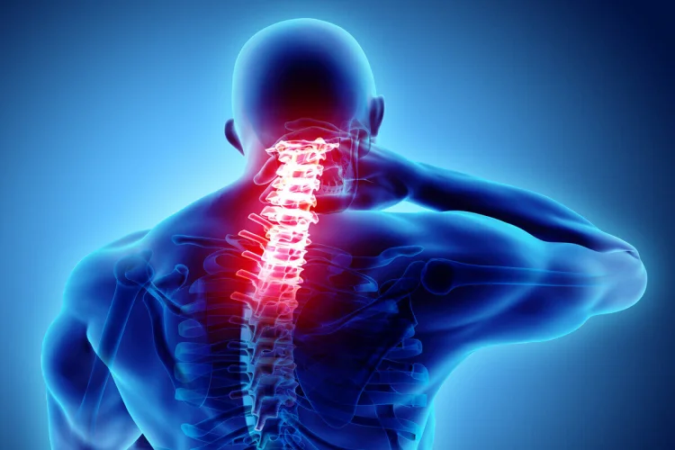 Dor na coluna: quando a cirurgia é indicada
