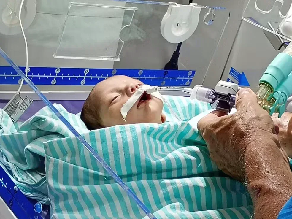 Bebê com malformação no coração tem piora e segue à espera de transferência no Acre Bebê com malformação no coração tem piora e segue à espera de transferência no Acre