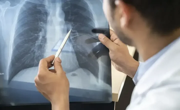 Anvisa aprova novo medicamento para câncer de pulmão avançado