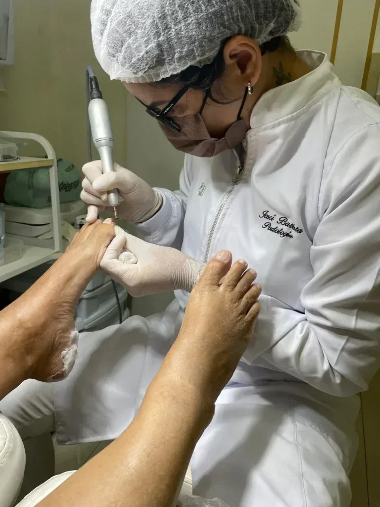 Podologia: cuidado especializado que vai muito além da estética dos pés Podologia: cuidado especializado que vai muito além da estética dos pés